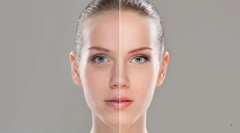 dull skin treatments